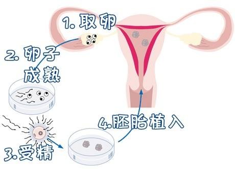有偿试管代妈机构生殖医学中心